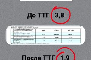 Работа с гипотериозом — Костякина Наталья Алексеевна