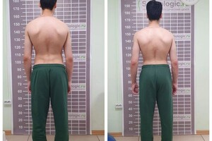 Лушникова Анастасия Викторовна — ЛФК для детей — Портфолио №1