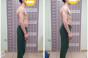 Лушникова Анастасия Викторовна — Коррекция положения стоп — Портфолио №2