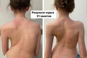 Чтобы добиться таких результатов, использовалась уникальная методика по оздоровлению позвоночника! — Раисат Шахбановна