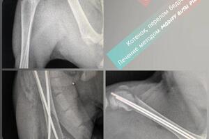 Надблоковый перелом бедренной кости у котенка 3 мес. Спрыгнул с плеча владельца. Типичный перелом для щенков и котят.... — Стратонов Андрей Сергеевич